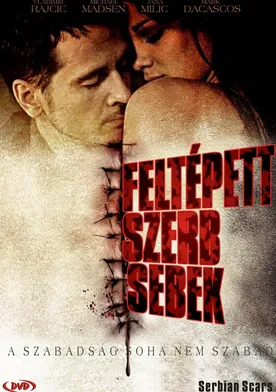 Poster Cicatrices serbias