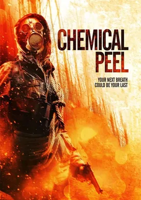 Poster Chemical Peel