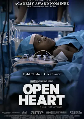 Poster Open Heart