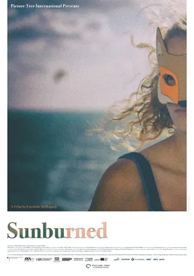 Poster Sunburned