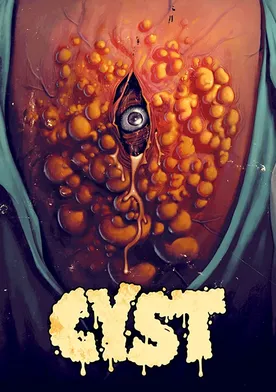 Poster Cyst