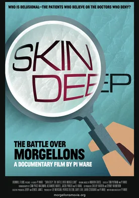 Poster Skin Deep: The Battle Over Morgellons